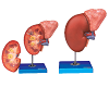 Kidney and Adrenal Gland